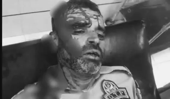 نواں کلی کوئٹہ میں رکشہ ڈرائیور کا ٹریفک پولیس اہلکار پر چھری سے حملہ