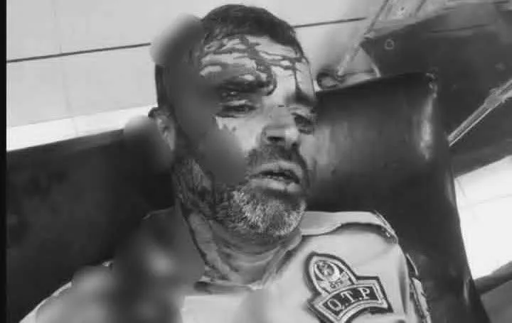 نواں کلی کوئٹہ میں رکشہ ڈرائیور کا ٹریفک پولیس اہلکار پر چھری سے حملہ