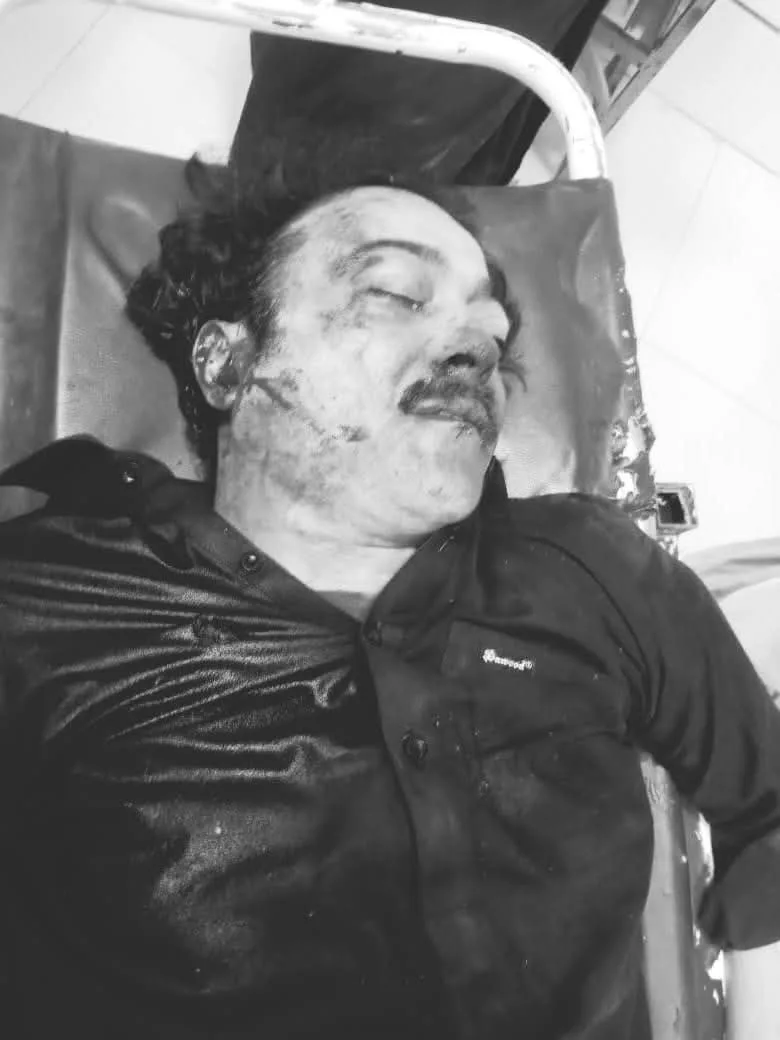 کوئٹہ کے وسطی علاقے جناح روڈ پر نامعلوم مسلح افراد کی فائرنگ ، پولیس زرائع