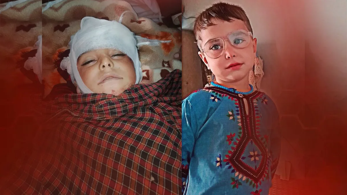 Rights groups challenge Pakistan’s claim of killing 150 militants, as children and civilians are reported among casualties in Nushki