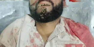 مستونگ روڈ پر فائرنگ، ہرنائی کا رہائشی ہلاک