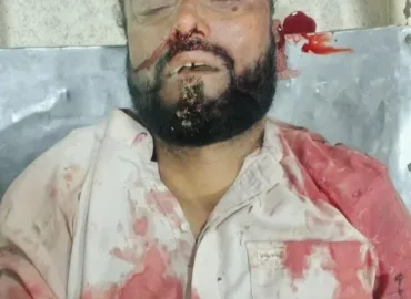 مستونگ روڈ پر فائرنگ، ہرنائی کا رہائشی ہلاک