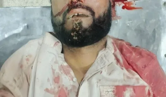 مستونگ روڈ پر فائرنگ، ہرنائی کا رہائشی ہلاک