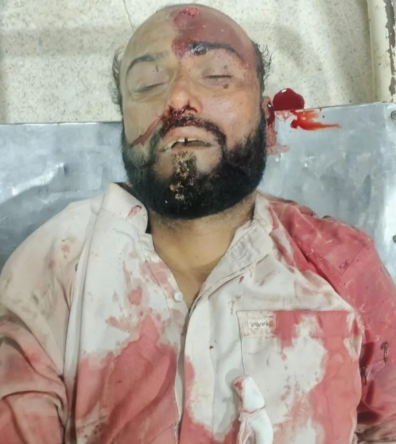 مستونگ روڈ پر فائرنگ، ہرنائی کا رہائشی ہلاک
