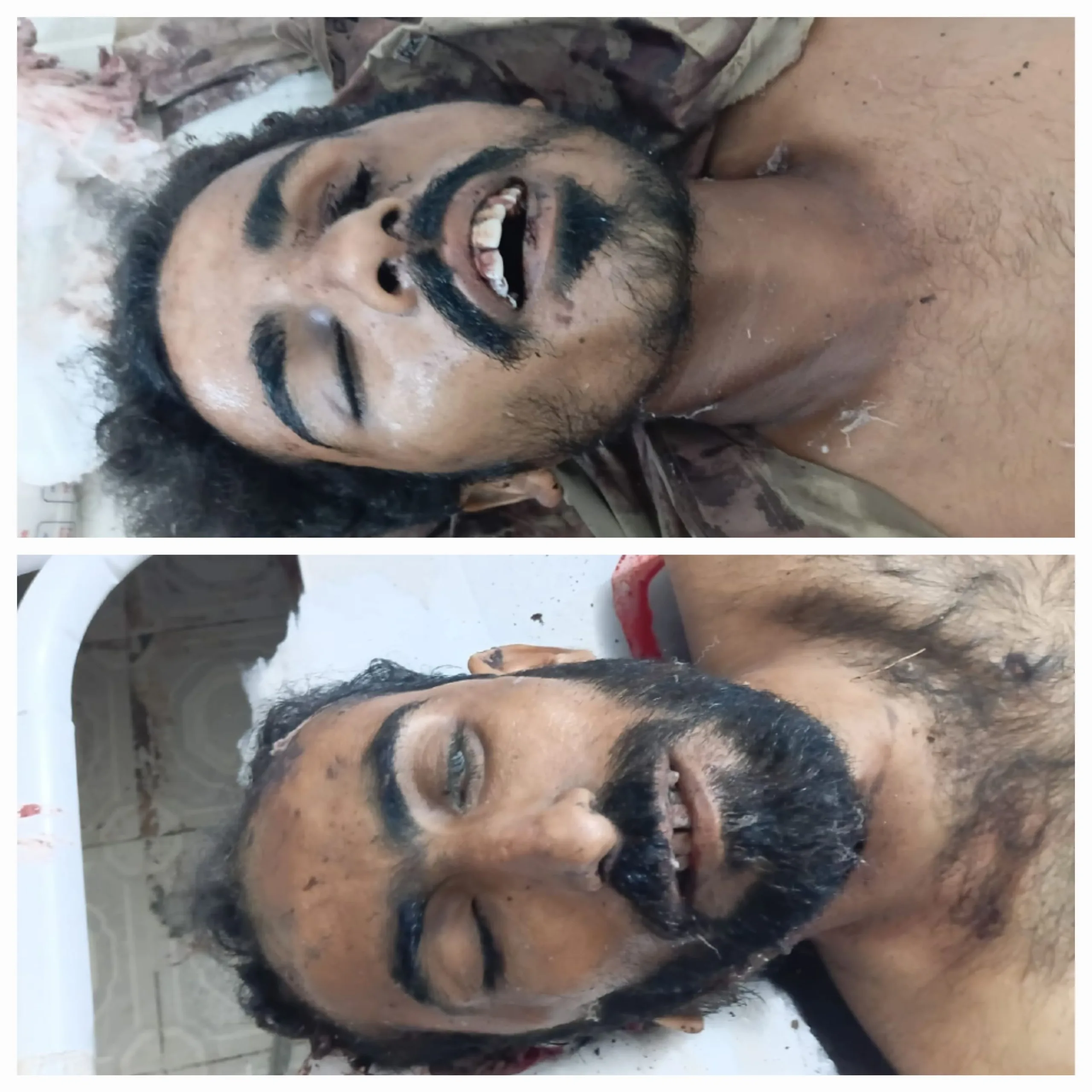تربت: ٹیچنگ اسپتال میں دو نامعلوم لاشیں منتقل، شناخت تاحال نہ ہوسکی