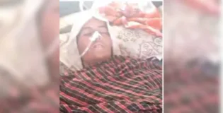 سوراب: پاکستانی فوجی بمباری کی ایک اور زخمی خاتون زخموں کی تاب نہ لاتے ہوئے شہید 