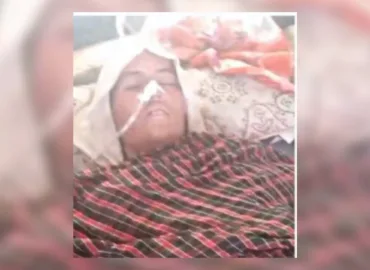 سوراب: پاکستانی فوجی بمباری کی ایک اور زخمی خاتون زخموں کی تاب نہ لاتے ہوئے شہید 